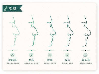 Solusi lengkap untuk koreksi malformasi hidung (nasal malformation correction)